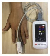 Non-Invasive Pulsed RF unit